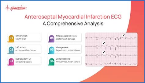 What does the medical term infarct mean?